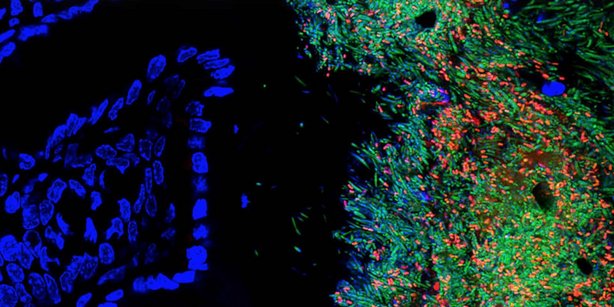 Picture of a microbiome
