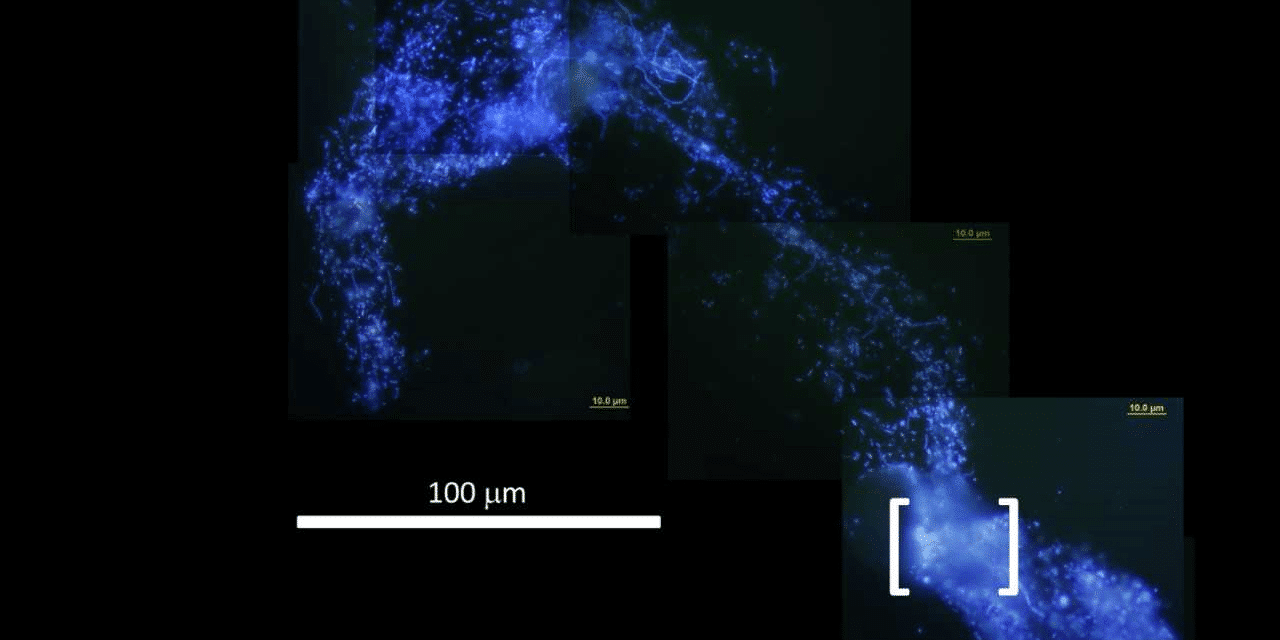 Microscopic view of a biological sample with blue fluorescent staining, shown in four sections with scale bars indicating 10 µm and 100 µm.